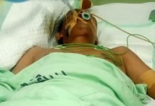 Keluarga Korban Laka Lantas Desak Polres Nias Tetapkan Tersangka Kasus Tabrakan