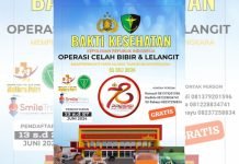 Polda Lampung Gelar Operasi Bibir Sumbing, Ini Cara Daftarnya